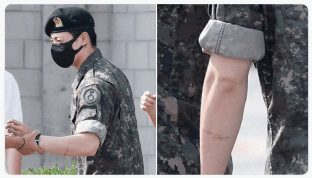 Jungkook de BTS aparece con lesiones en su brazo